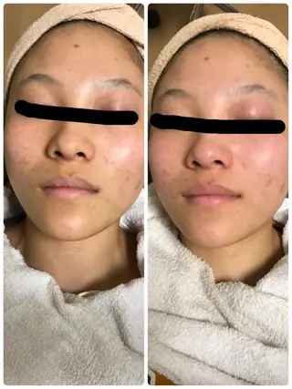 トータルエステサロン Tiaraのエステ・リラクイメージ