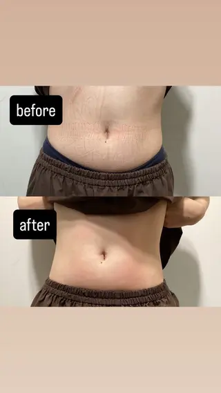 すずらん鍼灸整体院 首肩こり/腰痛/整体のエステ・リラクイメージ