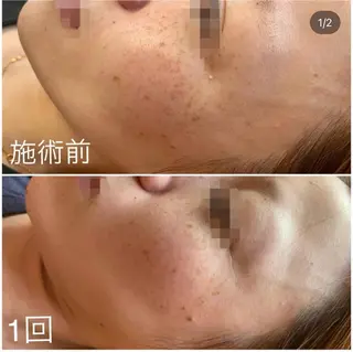 シミケア専門店 Saimervellのエステ・リラクイメージ