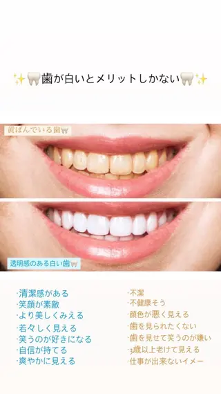 エクシアホワイト千葉駅前店所属・セルフホワイトニング エクシア千葉駅前店のその他イメージ