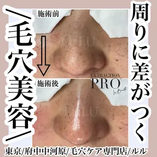 LULU所属・LULU ルルのエステ・リラクイメージ