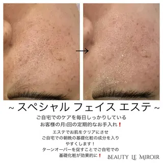 ビューティー ミロワールのエステ・リラクイメージ