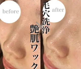 ハルモニア所属・エステハルモニア はるかのエステ・リラクイメージ