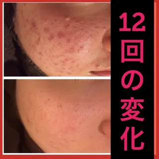 ミディアム カラー パーマ ヘアアレンジ メンズ キッズ ネイル マツエク・マツパ ニキビ・肌質改善専門 ♡人生が変わるサロンのエステ・リラクイメージ