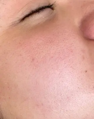 ADDICT中目黒店所属・毛穴洗浄/毛穴ケア 🌿中目黒🌿のエステ・リラクイメージ