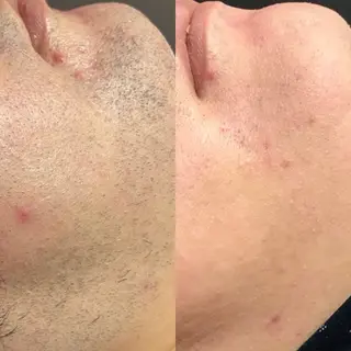 Lilyboo 池袋のエステ・リラクイメージ