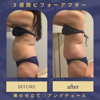 ﾌﾟﾗｲﾍﾞｰﾄｻﾛﾝ アンクチュール所属・UnCouture 〜アンクチュール〜のエステ・リラクイメージ