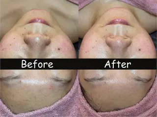 四ツ橋フェイシャル Rebornのエステ・リラクイメージ