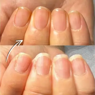 ネイル Tolano nailcareのネイルデザイン