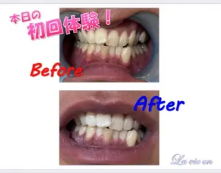 セルフホワイトニングサロン　ラヴィアン所属・ホワイトニングサロン La vie enのその他イメージ