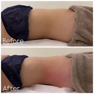 Lib Charm 北本結愛のエステ・リラクイメージ