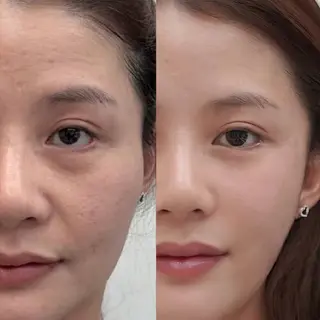 aliaハイフ&水光ジェットサロン所属・aliaハーブ水光店 エステティシャン募集のエステ・リラクイメージ