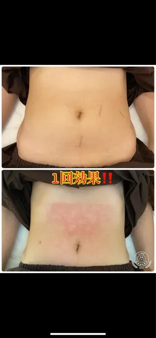 セミロング ネイル マツエク・マツパ 小顔矯正・美容鍼 美鍼堂のエステ・リラクイメージ