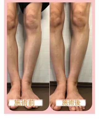 小顔・毛穴・たるみ ネイル　似内真樹のエステ・リラクイメージ