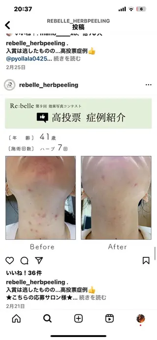 Liberte リベルテ(トモ化粧品店内)所属・RINA 🍒のマツエク・マツパデザイン