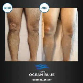 メンズ メンズオーシャンブルー福岡店所属・柿添 希実のエステ・リラクイメージ