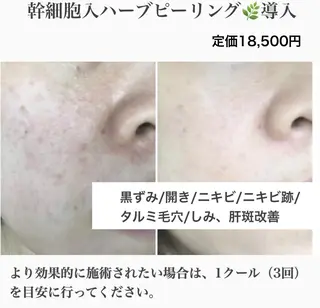 ―Chartresー Runaの眉毛・アイブロウイメージ