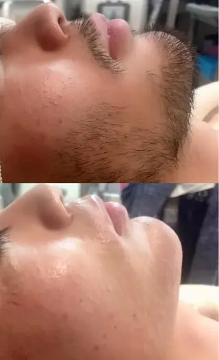 メンズ 髪質改善shoma mikiのヘアスタイル