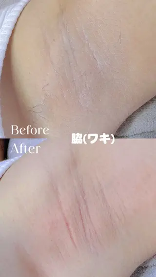 Hit. シュガーリング豊橋のエステ・リラクイメージ