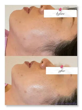 ð
ð
€ð
©ð
ð
salonã®ãšã¹ãã»ãªã©ã¯ã€ã¡ãŒãž