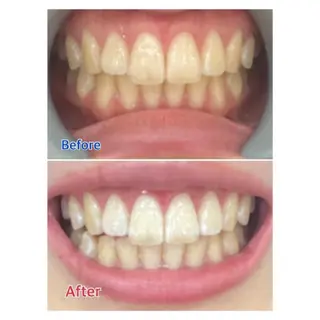 M渋谷店所属・Ｍ渋谷 ホワイトニングのその他イメージ