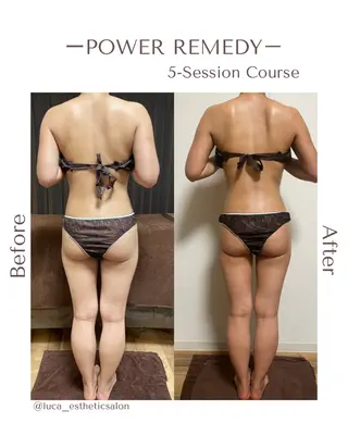 Luca所属・Luca ﾙｶのエステ・リラクイメージ