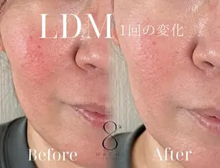 ebcs 8のエステ・リラクイメージ