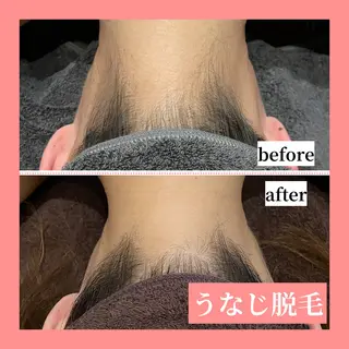 メンズ 天神【効果重視脱毛】 YouMakeのエステ・リラクイメージ