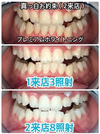 ☆専門店にお任せ☆ ホワイトニング吉祥寺のその他イメージ