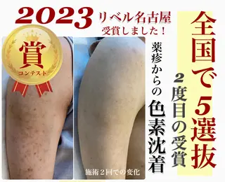 パーマ メンズ マツエク・マツパ 次世代まつげパーマは 『リベル名古屋』のマツエク・マツパデザイン