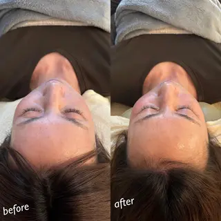 うなじ脱毛/美肌脱毛 LABELのエステ・リラクイメージ