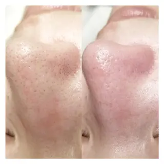 U_la所属・U_la [ウーラ] 片岡の眉毛・アイブロウイメージ