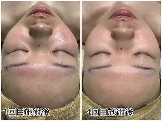 One .Erikaのエステ・リラクイメージ