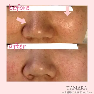 TAMARA 松下のエステ・リラクイメージ