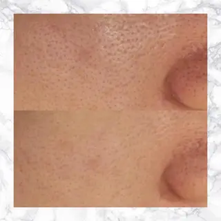 セミロング カラー パーマ ヘアアレンジ メンズ キッズ ネイル マツエク・マツパ アイブロウ 触れたくなる モテ肌へ...❤︎のエステ・リラクイメージ