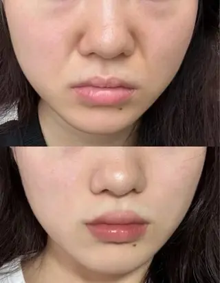 マツエク・マツパ aliaハイフ&水光ジェットサロン所属・aliaハーブ水光店 エステティシャン募集のエステ・リラクイメージ