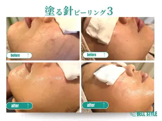 メンズ&レディース　Bell style所属・【脱毛・美肌専門】 bellstyleのエステ・リラクイメージ