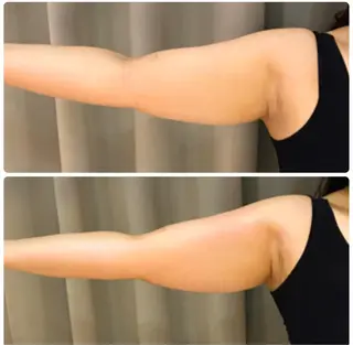 マツエク・マツパ 代表 MOMOのエステ・リラクイメージ