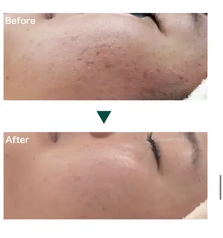 プライベートサロンbelle所属・プライベートサロン belleのエステ・リラクイメージ