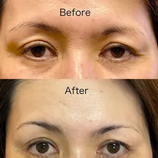 アイブロウ LUZ所属・LUZ ルースの眉毛・アイブロウイメージ