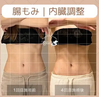 【頭痛、睡眠改善】 salon RUUのエステ・リラクイメージ