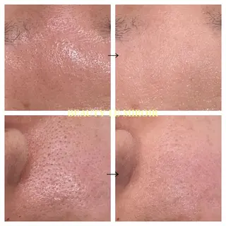 ビューティー ミロワールのエステ・リラクイメージ