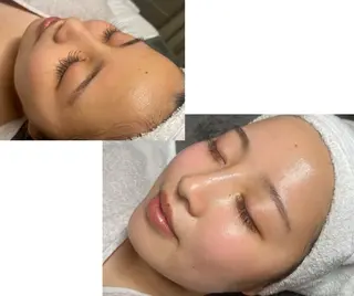 小顔/リンパ/マッサージL.sana所属・小顔/フェイシャル L.sanaのエステ・リラクイメージ