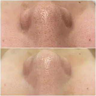 ララ/ハーブ メゾンリュバンのエステ・リラクイメージ