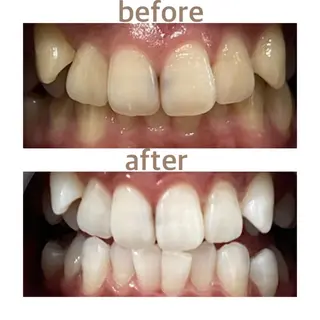 メンズ ホワイトニング ショップ本八幡店のエステ・リラクイメージ