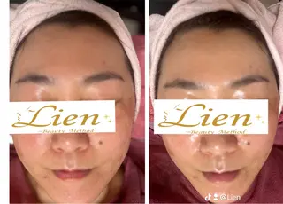 Lien オーナー　山口智嘉のエステ・リラクイメージ