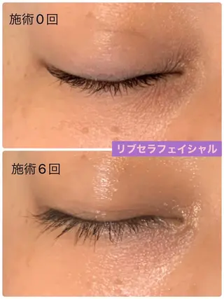 Private Salon Prunelle所属・プライベートサロン プリュネルのエステ・リラクイメージ