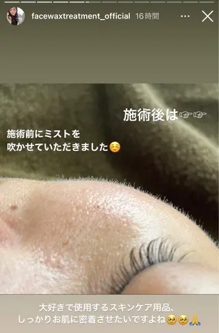 痩身・フェイシャル/if  byOrabriller所属・if byOrab riller【ｲﾌ】のその他イメージ