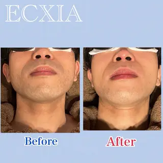 脱毛サロン ECXIA【博多】のエステ・リラクイメージ