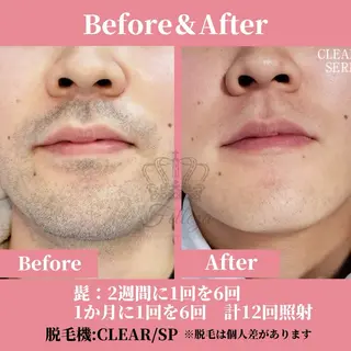 メンズ 有人型セルフサロン 脱毛/痩身/美顔のその他イメージ